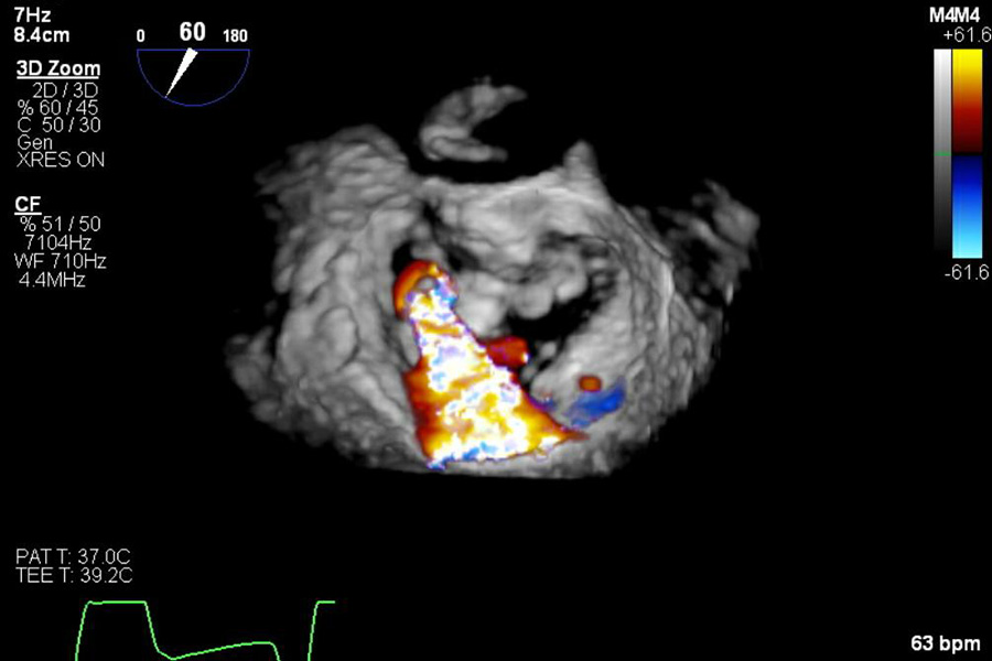 Echocardiography